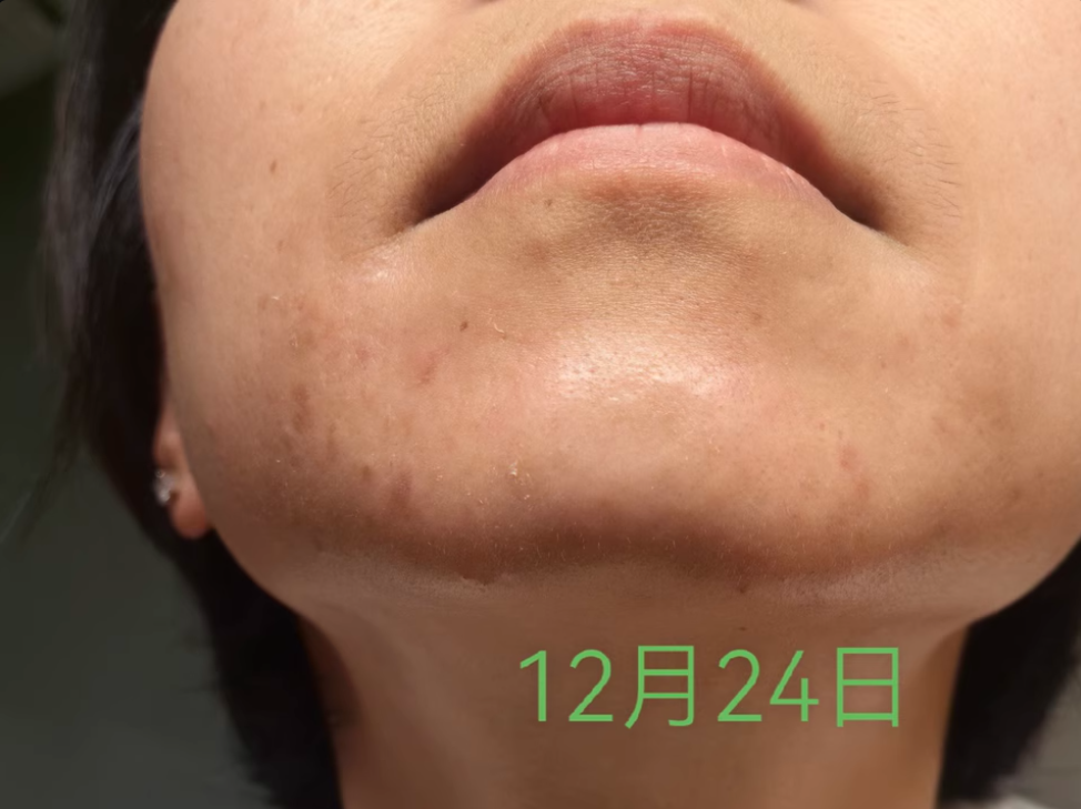 使用后