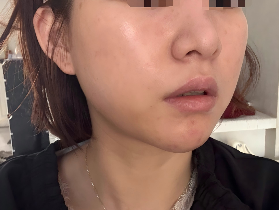 使用后