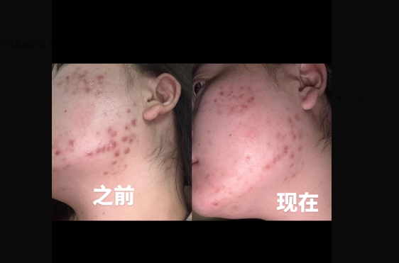 使用后