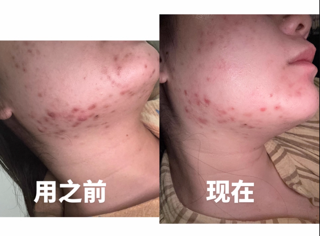 使用前